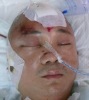 义工丘应宜深夜被歹徒袭击头部大量出血昏迷不醒