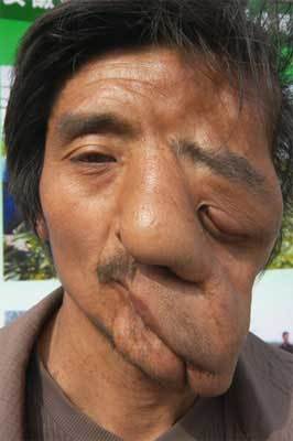 见皮肤病:他的面部,手背与脚上,长满了…