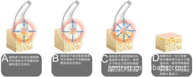 V8-CI 低頻爆脂,空穴爆脂,纖面體雕,美容機,真空負壓,射頻