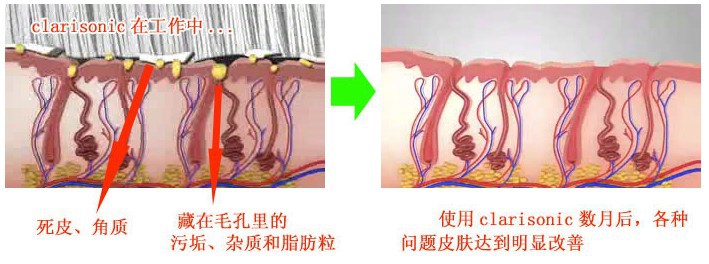 洁面刷Clarisonic Plus Ⅲ 描述图 (5)