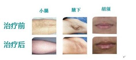 QQ图片20140221190048