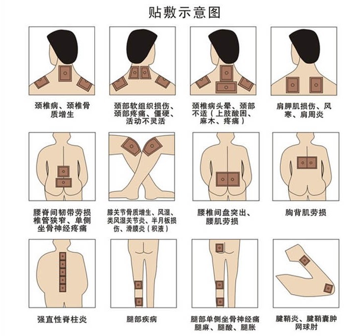 特价每10盒送2盒 医院特供 东方热磁理疗贴b型颈椎病肩周炎贴