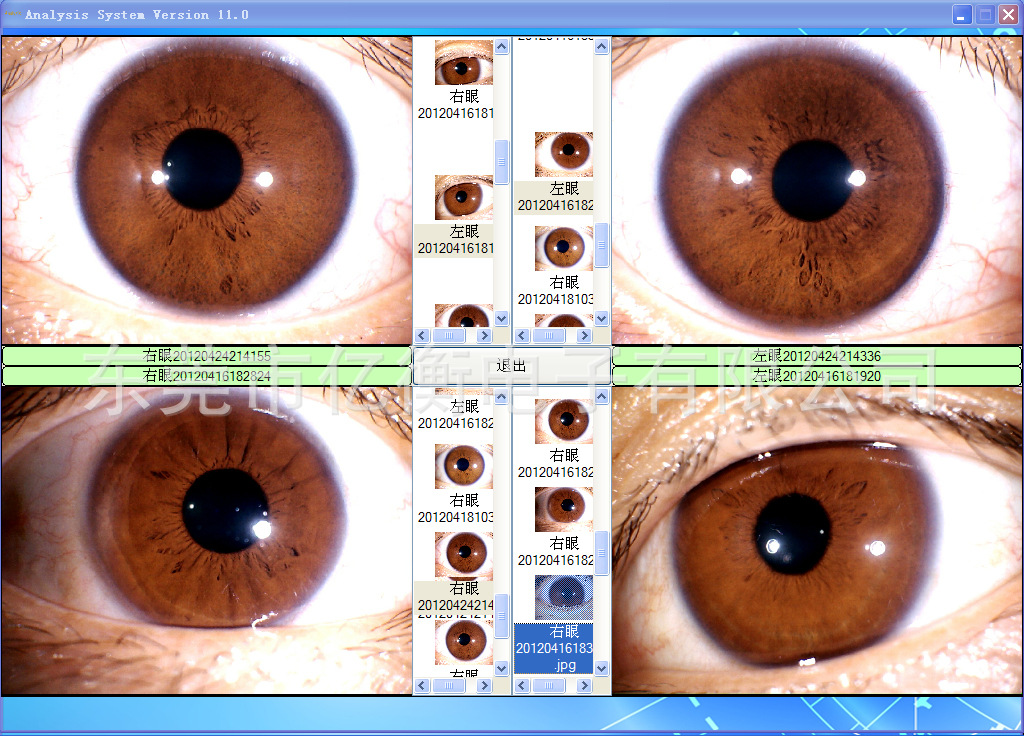 全新【500万像素】电脑型usb 虹膜检测仪【配虹膜自动分析软件】图片