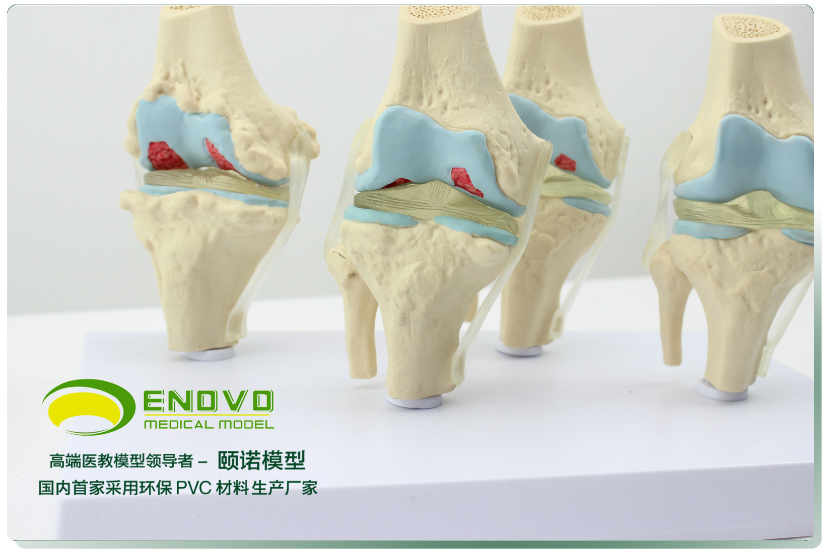 大量供应 病态膝关节骨骼模型 膝关节病理模型 enovo骨骼模型