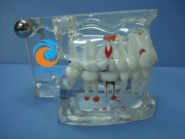 综合病理水晶牙列模型(28颗牙) bz-km053a